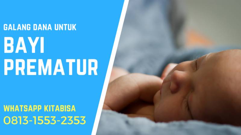 Tips Merawat Bayi Prematur
