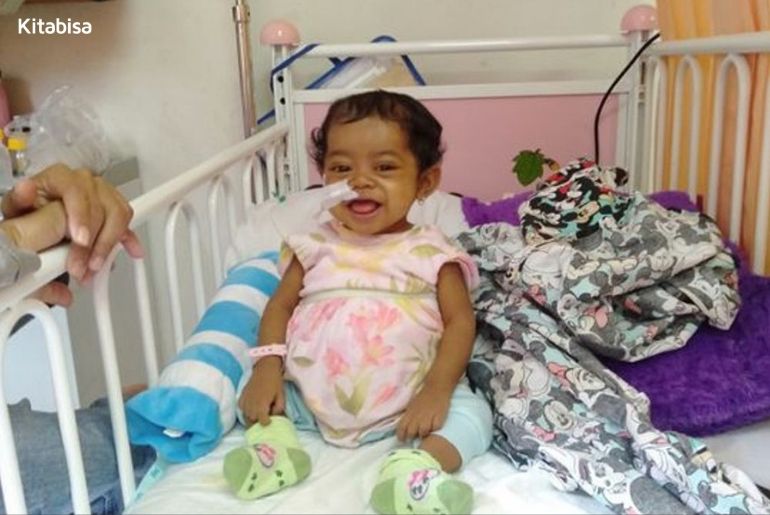 Transplantasi Hati untuk Pejuang Atresia Bilier, Nahda