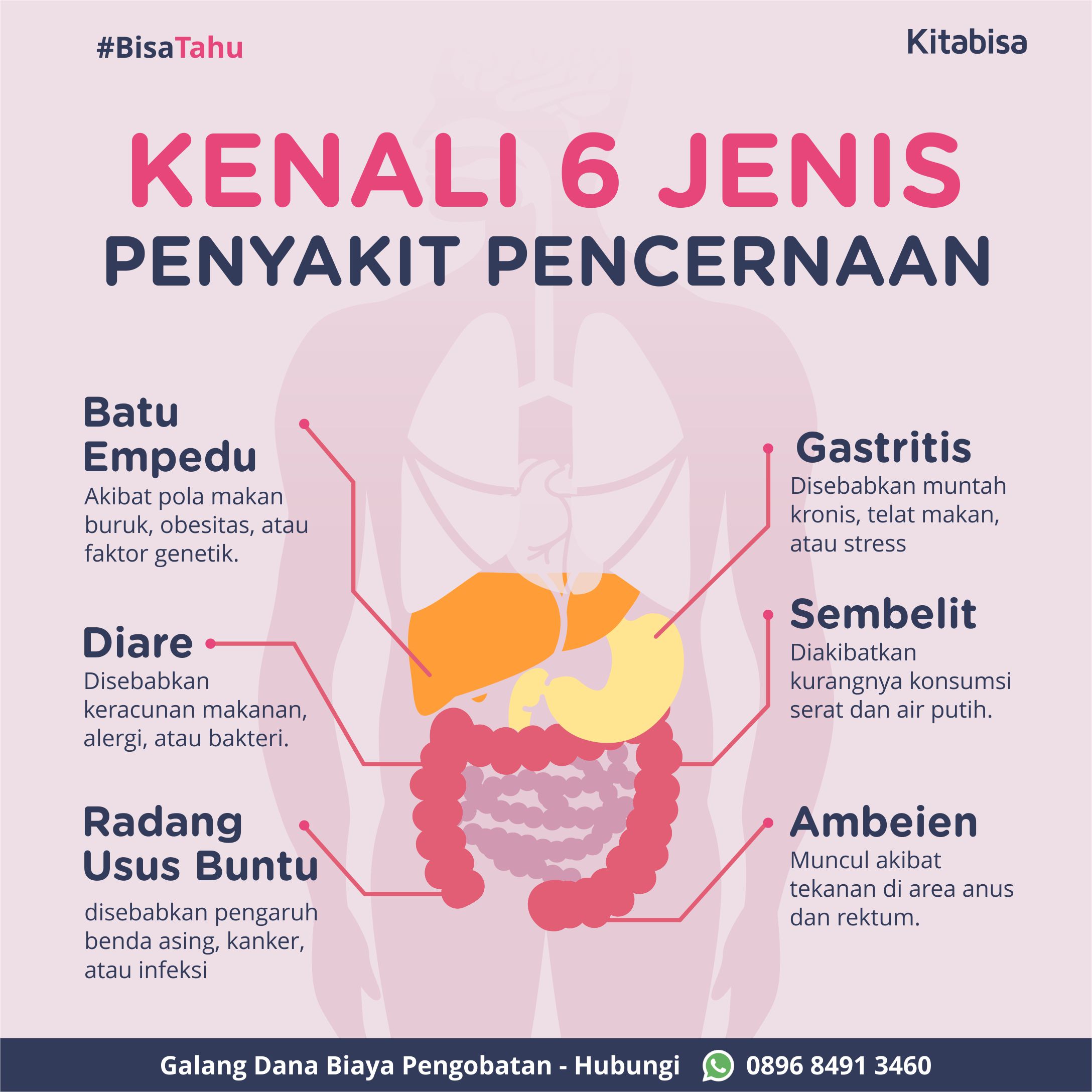 Jenis jenis Penyakit Pencernaan  yang Umum Ditemukan 