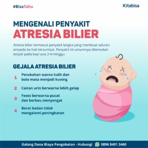 gejala atresia bilier