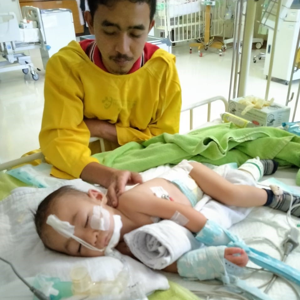Bayi Operasi Katarak dan Jantung Bocor 